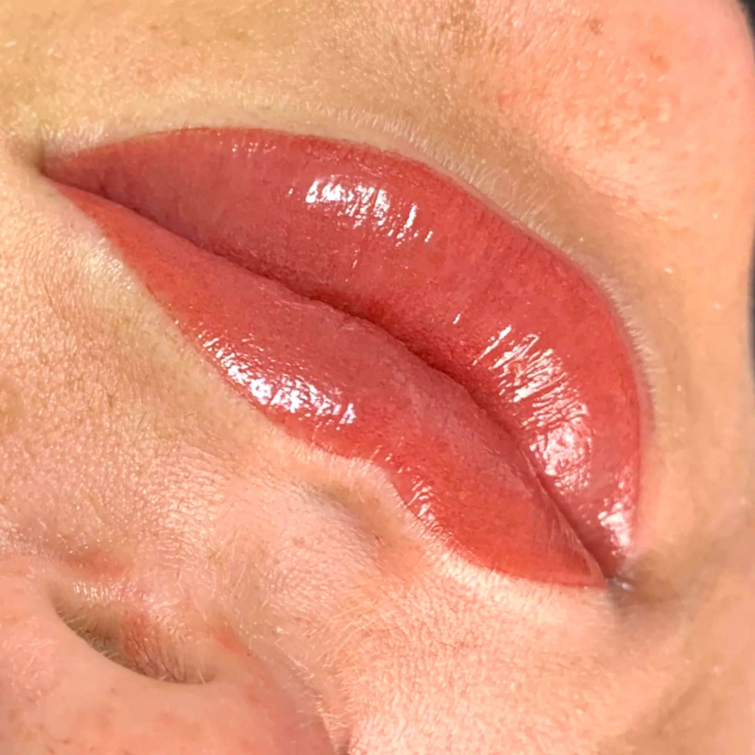keloids after cosmetic tattoo