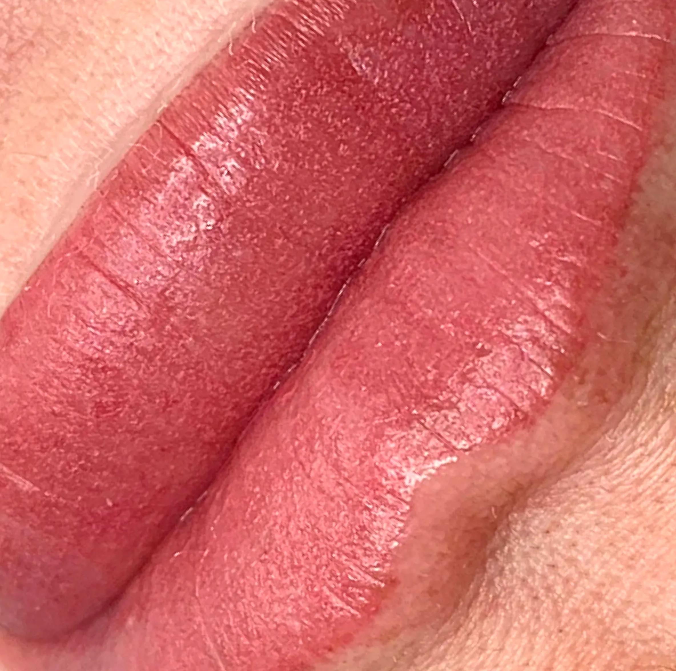 lip tattoo scar risk